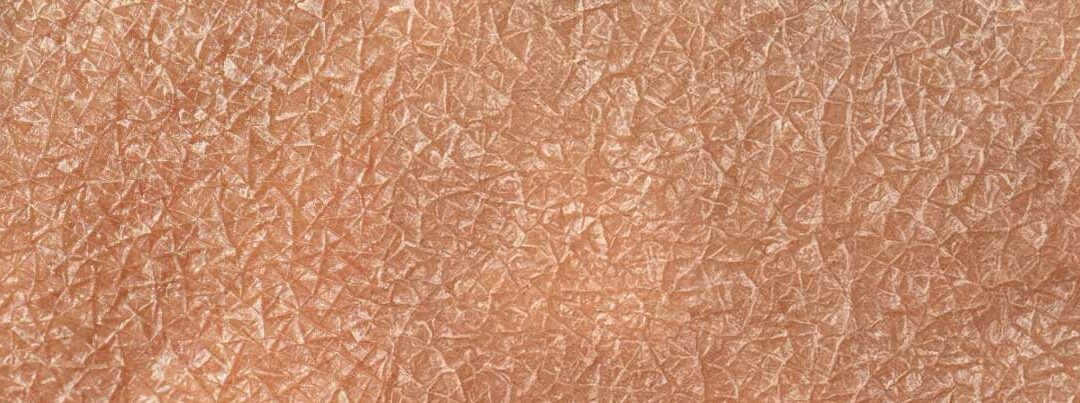 Deporte y piel: lo que pasa en tu piel cuando empiezas a entrenar