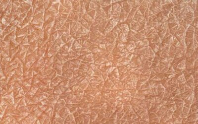 Deporte y piel: lo que pasa en tu piel cuando empiezas a entrenar