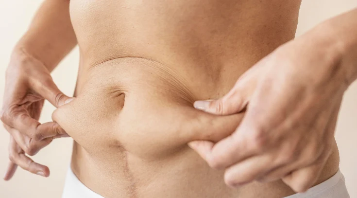 Cómo quitar grasa abdominal